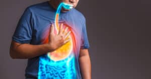 gastroesophageal reflux disease (GERD)